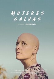 Mujeres calvas