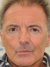  Armand Assante