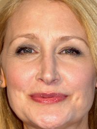  Patricia Clarkson