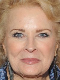  Candice Bergen