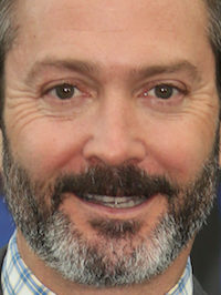  Thomas Lennon