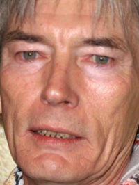  Billy Drago