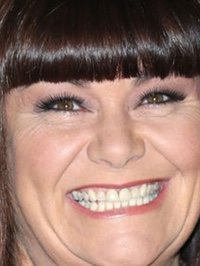  Dawn French