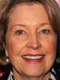  Anne Reid