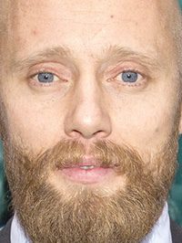  Aksel Hennie