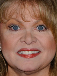  Sally Struthers